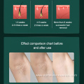 Beauty Equipemnt Ipl Hair Removal For Mens